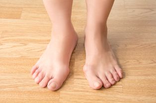bunion surgery